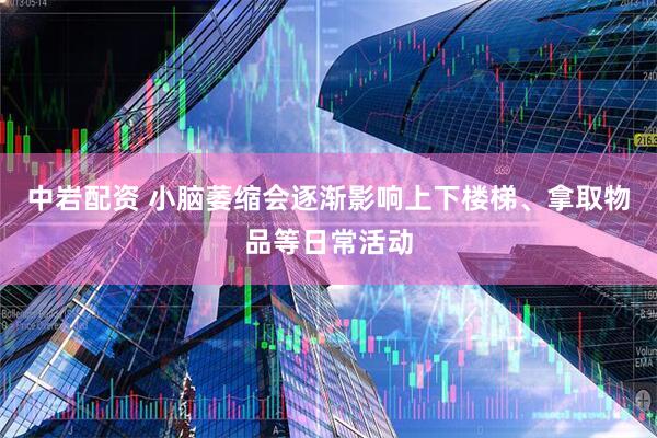 中岩配资 小脑萎缩会逐渐影响上下楼梯、拿取物品等日常活动
